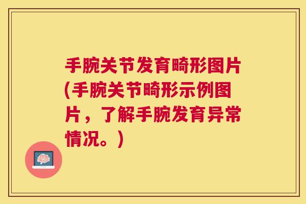手腕关节发育畸形图片(手腕关节畸形示例图片，了解手腕发育异常情况。)