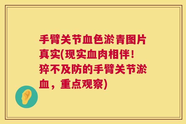 手臂关节血色淤青图片真实(现实血肉相伴！猝不及防的手臂关节淤血，重点观察)