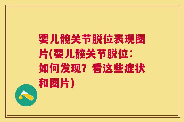 婴儿髋关节脱位表现图片(婴儿髋关节脱位：如何发现？看这些症状和图片)