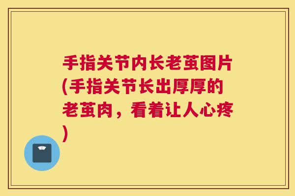 手指关节内长老茧图片(手指关节长出厚厚的老茧肉，看着让人心疼)