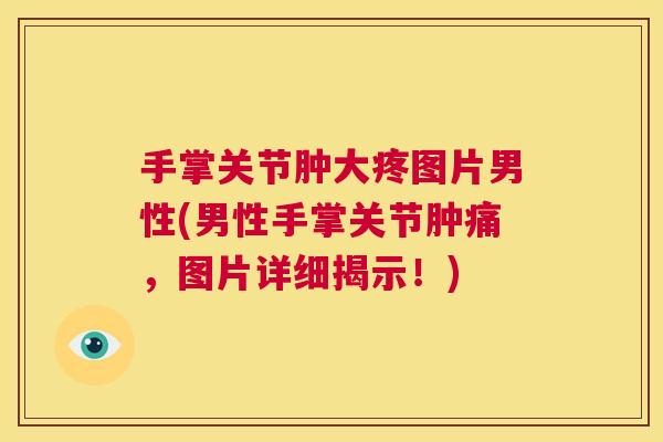 手掌关节肿大疼图片男性(男性手掌关节肿痛，图片详细揭示！)