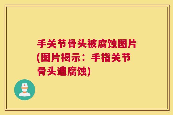 手关节骨头被腐蚀图片(图片揭示：手指关节骨头遭腐蚀)