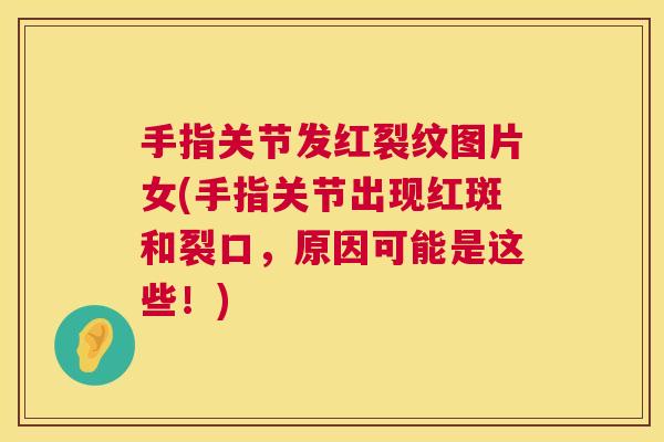 手指关节发红裂纹图片女(手指关节出现红斑和裂口，原因可能是这些！)