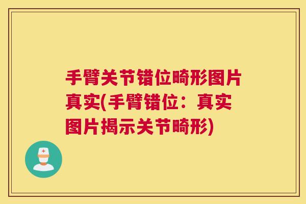 手臂关节错位畸形图片真实(手臂错位：真实图片揭示关节畸形)