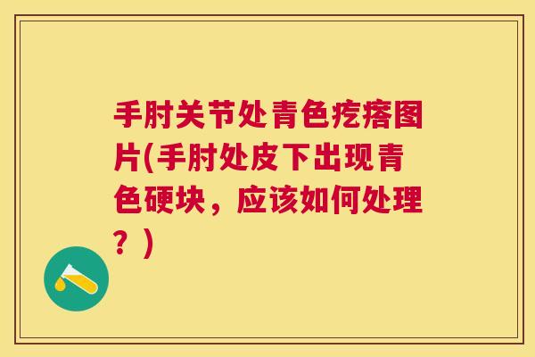 手肘关节处青色疙瘩图片(手肘处皮下出现青色硬块，应该如何处理？)