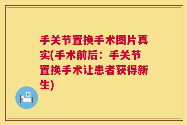 手关节置换手术图片真实(手术前后：手关节置换手术让患者获得新生)