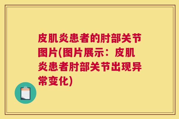 皮肌炎患者的肘部关节图片(图片展示：皮肌炎患者肘部关节出现异常变化)