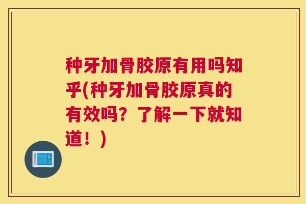 种牙加骨胶原有用吗知乎(种牙加骨胶原真的有效吗？了解一下就知道！)