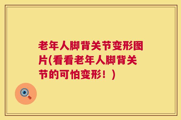 老年人脚背关节变形图片(看看老年人脚背关节的可怕变形！)