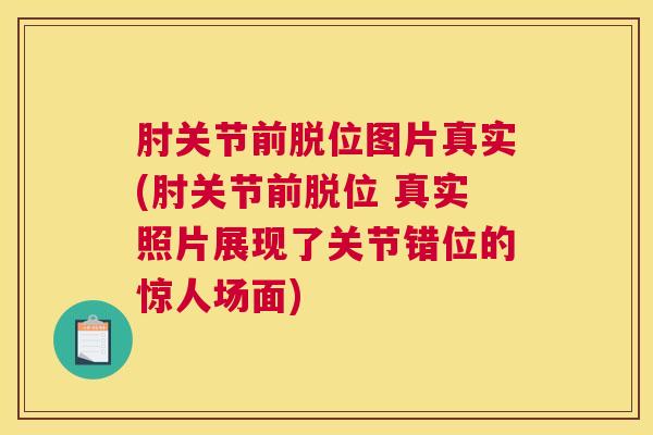 肘关节前脱位图片真实(肘关节前脱位 真实照片展现了关节错位的惊人场面)