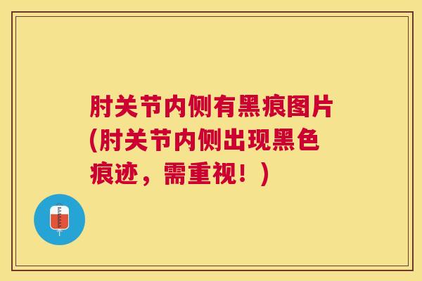 肘关节内侧有黑痕图片(肘关节内侧出现黑色痕迹，需重视！)
