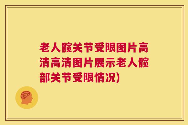 老人髋关节受限图片高清高清图片展示老人髋部关节受限情况)