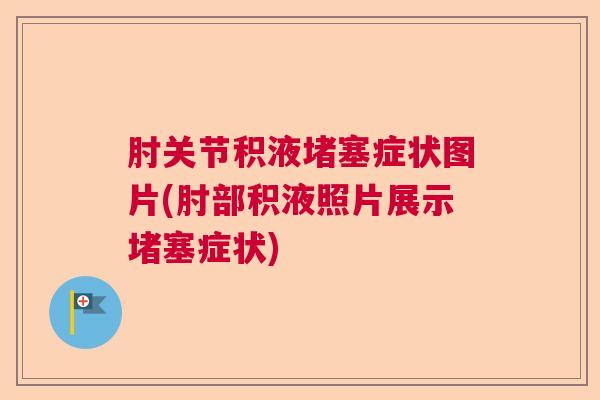 肘关节积液堵塞症状图片(肘部积液照片展示堵塞症状)