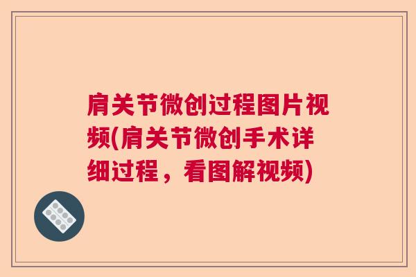 肩关节微创过程图片视频(肩关节微创手术详细过程，看图解视频)