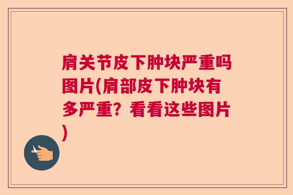 肩关节皮下肿块严重吗图片(肩部皮下肿块有多严重？看看这些图片)