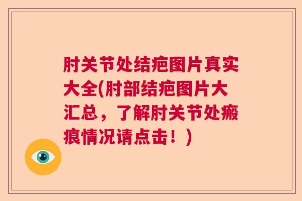 肘关节处结疤图片真实大全(肘部结疤图片大汇总，了解肘关节处瘢痕情况请点击！)