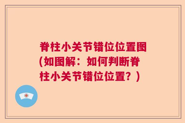 脊柱小关节错位位置图(如图解：如何判断脊柱小关节错位位置？)