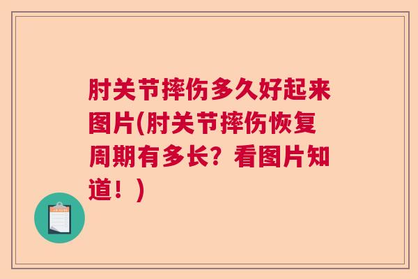 肘关节摔伤多久好起来图片(肘关节摔伤恢复周期有多长？看图片知道！)
