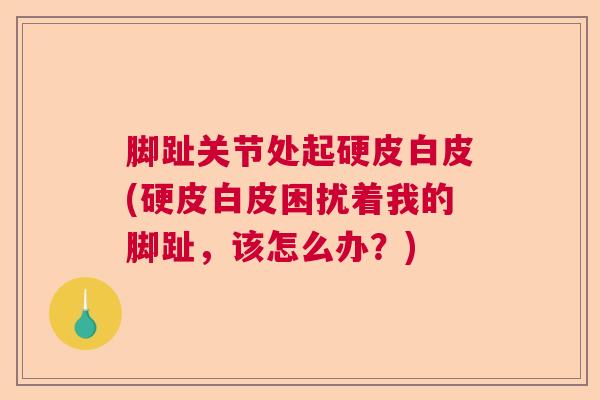脚趾关节处起硬皮白皮(硬皮白皮困扰着我的脚趾，该怎么办？)