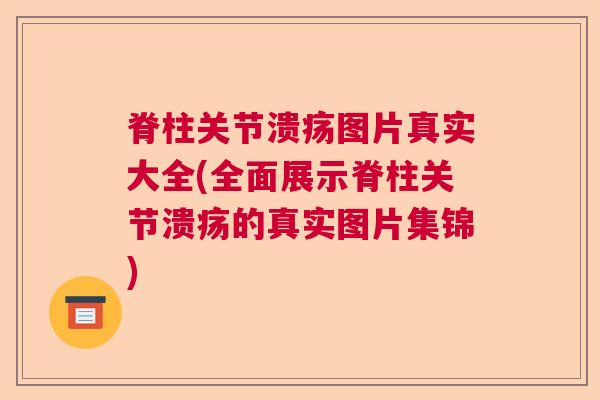 脊柱关节溃疡图片真实大全(全面展示脊柱关节溃疡的真实图片集锦)