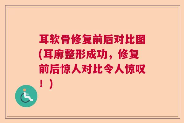 耳软骨修复前后对比图(耳廓整形成功，修复前后惊人对比令人惊叹！)