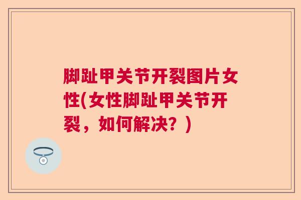 脚趾甲关节开裂图片女性(女性脚趾甲关节开裂，如何解决？)