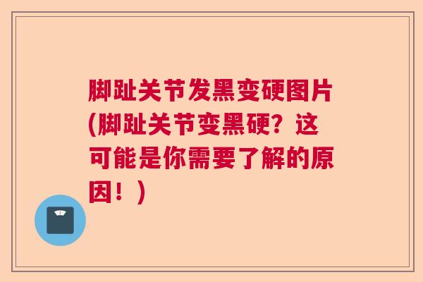 脚趾关节发黑变硬图片(脚趾关节变黑硬？这可能是你需要了解的原因！)