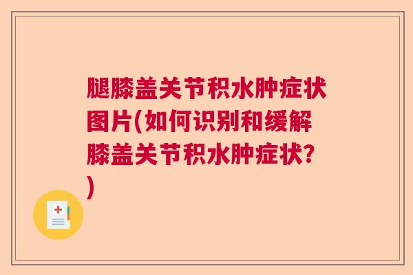 腿膝盖关节积水肿症状图片(如何识别和缓解膝盖关节积水肿症状?) 腿膝盖关节积水肿症状图片(如何识别和缓解膝盖关节积水肿症状?)