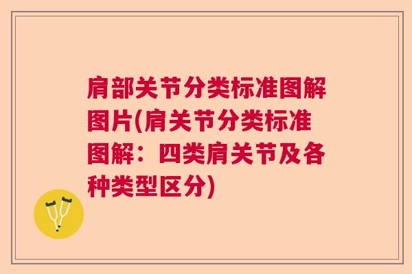 肩部关节分类标准图解图片(肩关节分类标准图解:四类肩关节及各种类型区分) 肩部关节分类标准图解图片(肩关节分类标准图解:四类肩关节及各种类型区分)