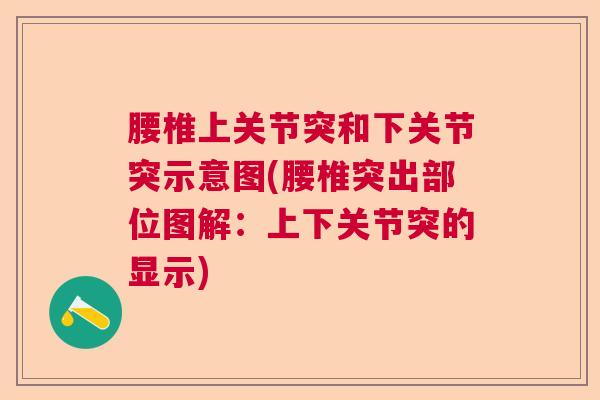 腰椎上关节突和下关节突示意图(腰椎突出部位图解：上下关节突的显示)