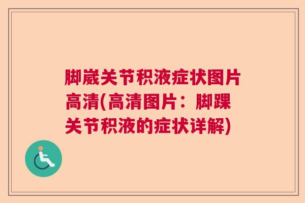 脚崴关节积液症状图片高清(高清图片：脚踝关节积液的症状详解)