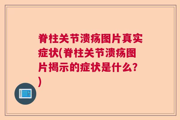 脊柱关节溃疡图片真实症状(脊柱关节溃疡图片揭示的症状是什么?) 脊柱关节溃疡图片真实症状(脊柱关节溃疡图片揭示的症状是什么?)