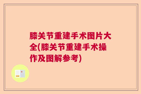 膝关节重建手术图片大全(膝关节重建手术操作及图解参考)