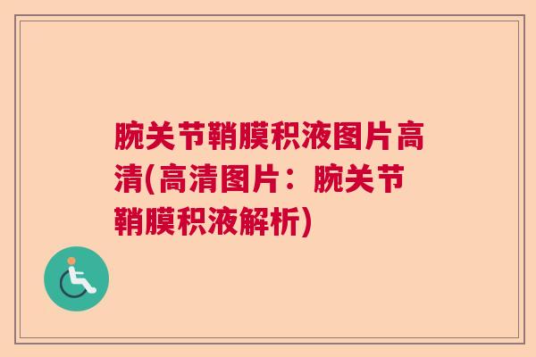腕关节鞘膜积液图片高清(高清图片：腕关节鞘膜积液解析)