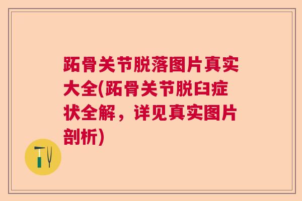 跖骨关节脱落图片真实大全(跖骨关节脱臼症状全解，详见真实图片剖析)