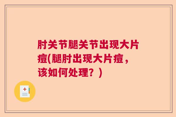 肘关节腿关节出现大片痘(腿肘出现大片痘，该如何处理？)