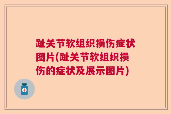 趾关节软组织损伤症状图片(趾关节软组织损伤的症状及展示图片)