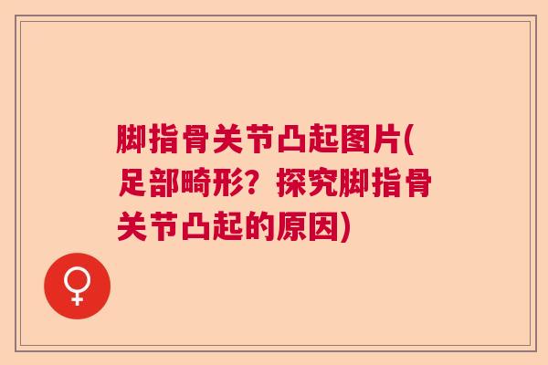 脚指骨关节凸起图片(足部畸形？探究脚指骨关节凸起的原因)