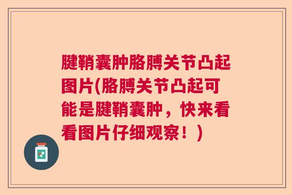腱鞘囊肿胳膊关节凸起图片(胳膊关节凸起可能是腱鞘囊肿，快来看看图片仔细观察！)