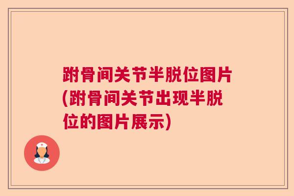 跗骨间关节半脱位图片(跗骨间关节出现半脱位的图片展示)