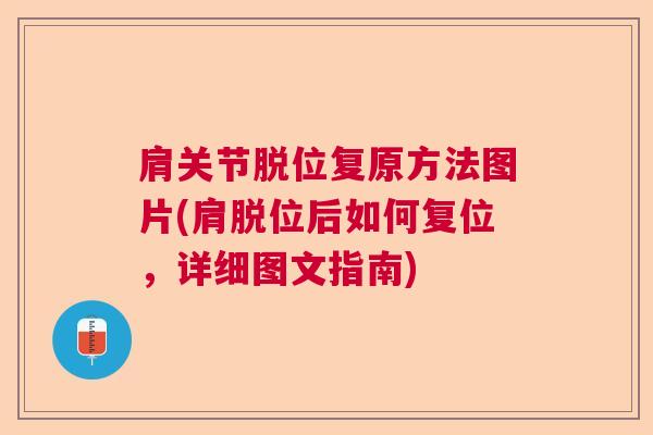 肩关节脱位复原方法图片(肩脱位后如何复位，详细图文指南)