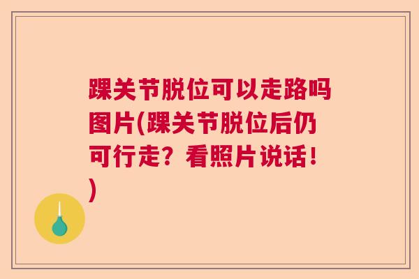踝关节脱位可以走路吗图片(踝关节脱位后仍可行走？看照片说话！)