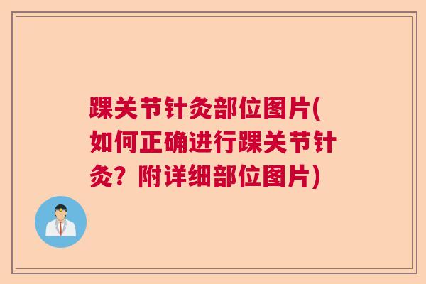 踝关节针灸部位图片(如何正确进行踝关节针灸？附详细部位图片)