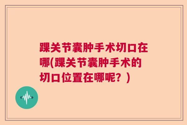踝关节囊肿手术切口在哪(踝关节囊肿手术的切口位置在哪呢？)